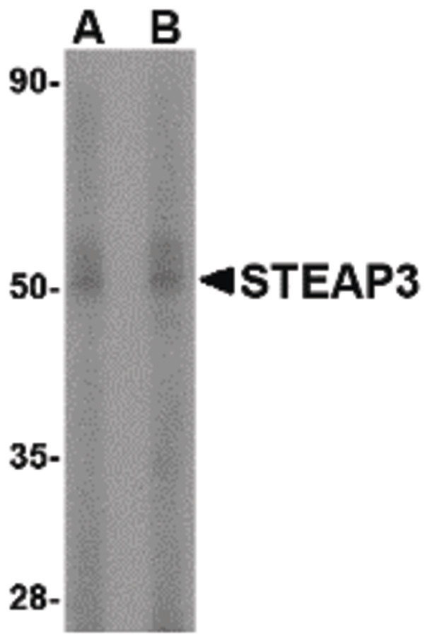 TSAP6 / STEAP3 Antibody - Western blot of STEAP3 in rat liver tissue lysate with STEAP3 antibody at (A) 1 and (B) 2 ug/ml.