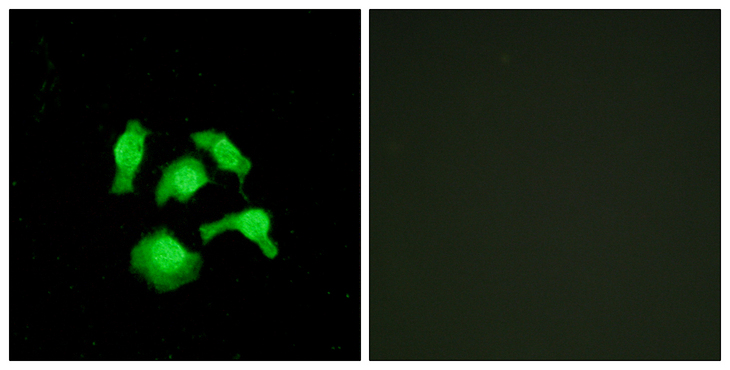 TSC22D1 / TSC22 Antibody - Immunofluorescence analysis of HepG2 cells, using TSC22D1 Antibody. The picture on the right is blocked with the synthesized peptide.