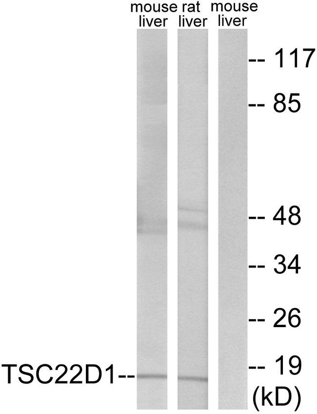 TSC22D1 / TSC22 Antibody - Western blot analysis of lysates from mouse liver and rat liver cells, using TSC22D1 Antibody. The lane on the right is blocked with the synthesized peptide.