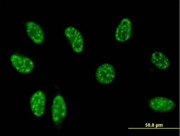 TSC22D3 / GILZ Antibody - Immunofluorescence of monoclonal antibody to TSC22D3 on HeLa cell (antibody concentration 10 ug/ml).