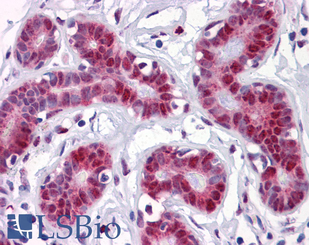 TSC22D3 / GILZ Antibody - Anti-TSC22D3 antibody IHC of human breast. Immunohistochemistry of formalin-fixed, paraffin-embedded tissue after heat-induced antigen retrieval. Antibody concentration 5 ug/ml.