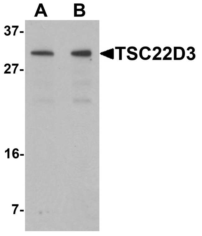 TSC22D3 / GILZ Antibody - Western blot analysis of TSC22D3 in human small intestine tissue lysate with TSC22D3 antibody at (A) 1 and (B) 2 ug/ml.
