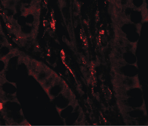 TSC22D3 / GILZ Antibody - Immunofluorescence of TSC22D3 in human small intestine tissue with TSC22D3 antibody at 20 ug/ml.