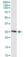 TSG / TWSG1 Antibody - TWSG1 monoclonal antibody (M07), clone 2F3. Western blot of TWSG1 expression in human kidney.