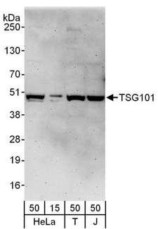 TSG101 Antibody - Detection of Human TSG101 by Western Blot. Samples: Whole cell lysate from HeLa (15 and 50 ug), 293T (T; 50 ug) and Jurkat (J; 50 ug) cells. Antibodies: Affinity purified rabbit anti-TSG101 antibody used for WB at 0.04 ug/ml. Detection: Chemiluminescence with an exposure time of 3 minutes.