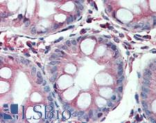 TSG101 Antibody - Human Colon: Formalin-Fixed, Paraffin-Embedded (FFPE)