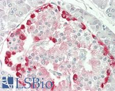 TSG101 Antibody - Human Pancreas: Formalin-Fixed, Paraffin-Embedded (FFPE)