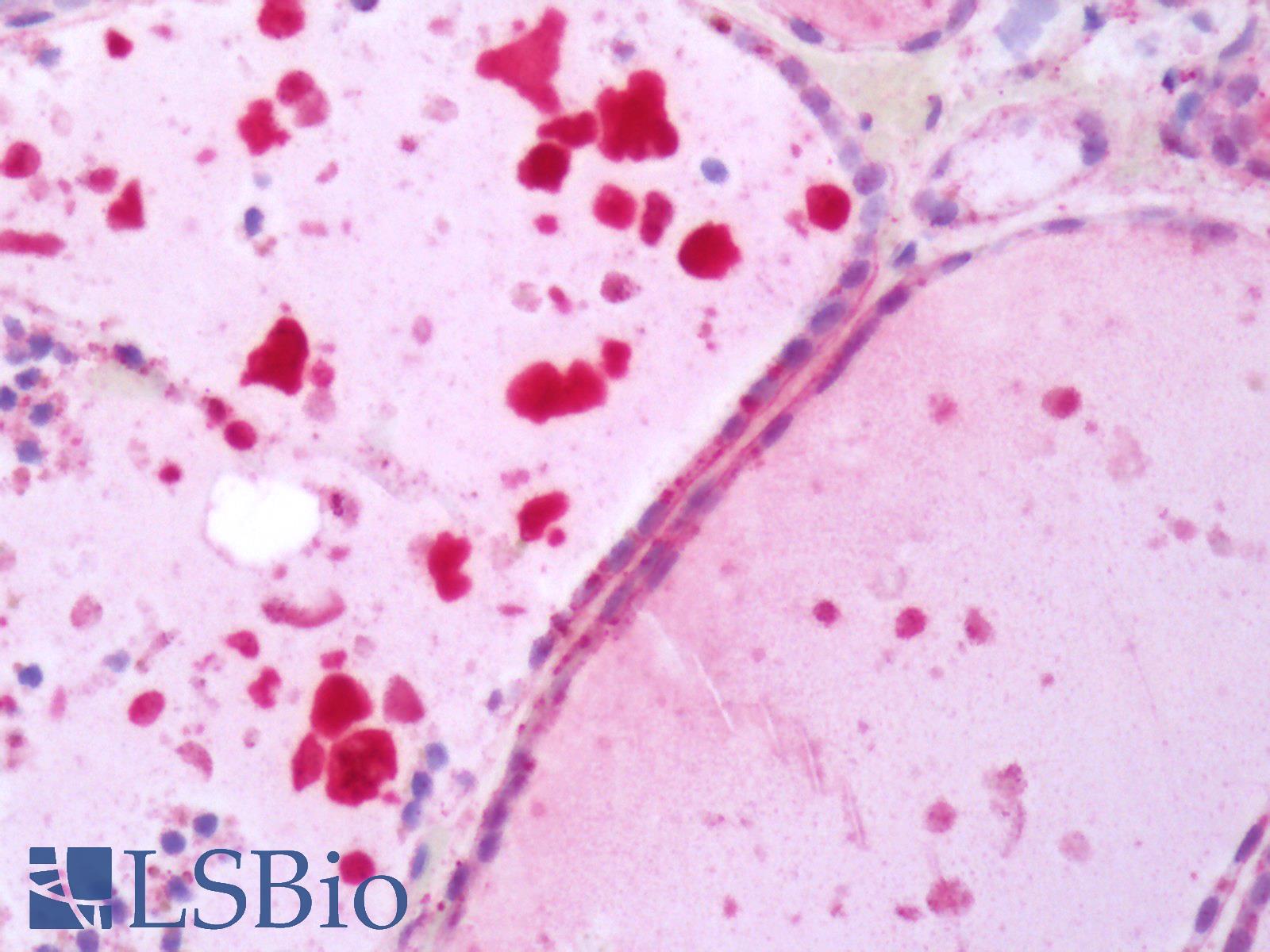 TSH Receptor / TSHR Antibody - Human Thyroid: Formalin-Fixed, Paraffin-Embedded (FFPE)
