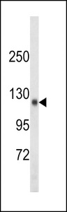 TSHZ1 Antibody - Western blot of SDCCAG33 Antibody in mouse kidney tissue lysates (35 ug/lane). SDCCAG33 (arrow) was detected using the purified antibody.