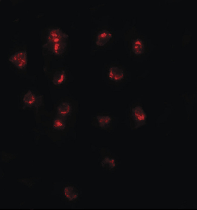 TSHZ1 Antibody - Immunofluorescence of TSHZ1 in A20 cells with TSHZ1 antibody at 20 ug/ml.