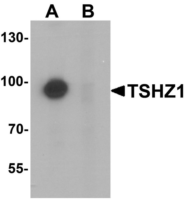 TSHZ1 Antibody - Western blot analysis of TSHZ1 in A-20 cell lysate with TSHZ1 antibody at 1 ug/ml in (A) the absence and (B) the presence of blocking peptide.