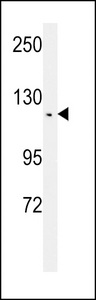 TSHZ2 Antibody - Western blot of TSH2 Antibody in CEM cell line lysates (35 ug/lane). TSH2 (arrow) was detected using the purified antibody.