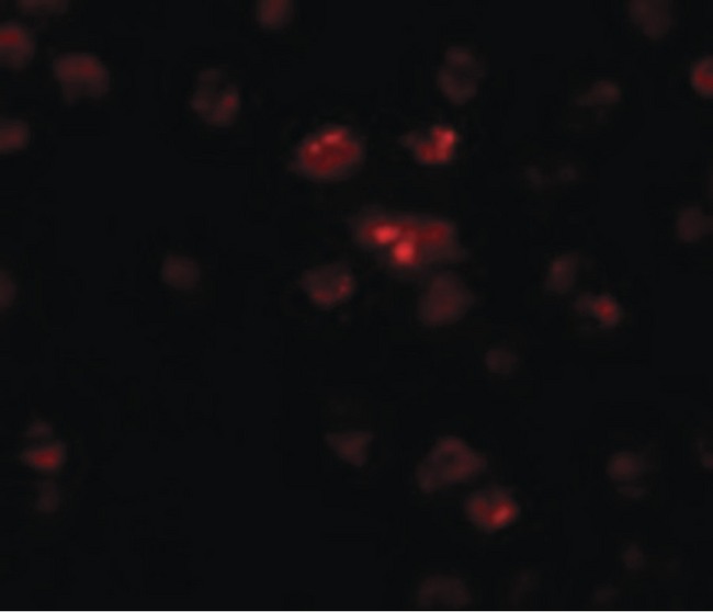 TSHZ2 Antibody - Immunofluorescence of TSHZ2 in A20 cells with TSHZ2 antibody at 20 ug/ml.