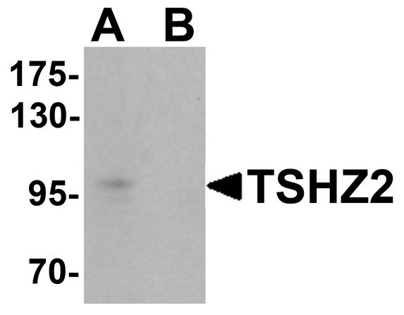 TSHZ2 Antibody - Western blot analysis of TSHZ2 in A-20 cell lysate with TSHZ2 antibody at 1 ug/ml in (A) the absence and (B) the presence of blocking peptide.