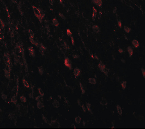 TSHZ3 Antibody - Immunofluorescence of TSHZ3 in mouse brain tissue with TSHZ3 antibody at 20 ug/ml.