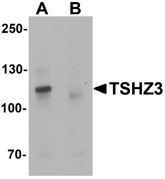 TSHZ3 Antibody - Western blot analysis of TSHZ3 in mouse brain tissue lysate with TSHZ3 antibody at 1 ug/ml in (A) the absence and (B) the presence of blocking peptide.