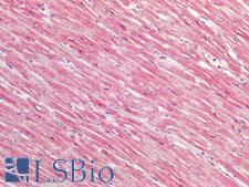 TSLP Antibody - Human Heart: Formalin-Fixed, Paraffin-Embedded (FFPE)