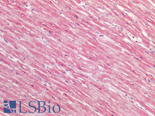 TSLP Antibody - Human Heart: Formalin-Fixed, Paraffin-Embedded (FFPE)