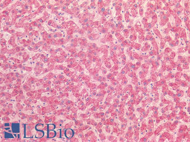 TSLP Antibody - Human Liver: Formalin-Fixed, Paraffin-Embedded (FFPE)