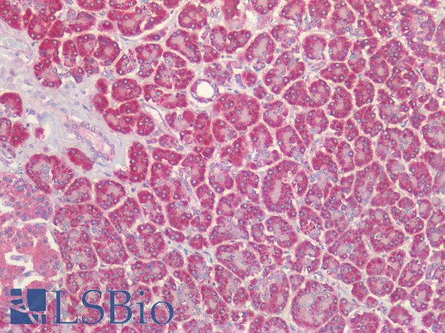 TSLP Antibody - Human Pancreas: Formalin-Fixed, Paraffin-Embedded (FFPE)