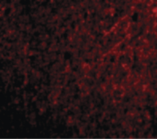 TSLP Antibody - Immunofluorescence of TSLP in Human Brain cells with TSLP antibody at 20 ug/ml.