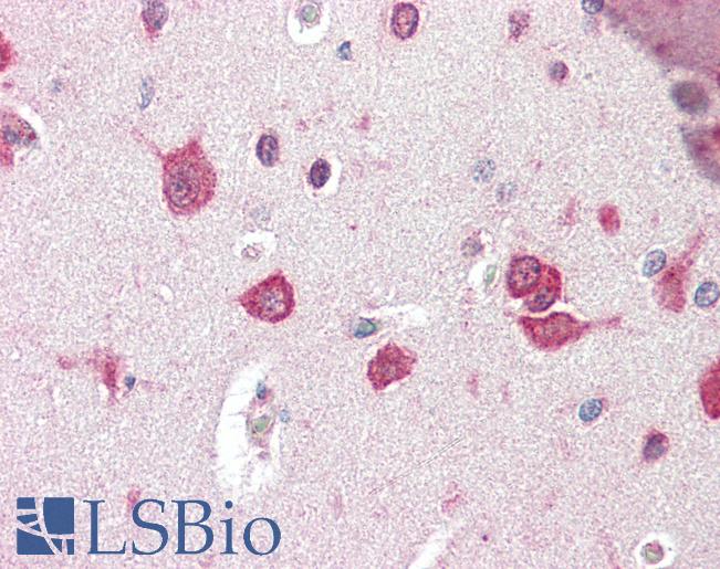 TSLP Antibody - Anti-TSLP antibody IHC of human brain, cortex pyramidal cells. Immunohistochemistry of formalin-fixed, paraffin-embedded tissue after heat-induced antigen retrieval. Antibody concentration 5 ug/ml.