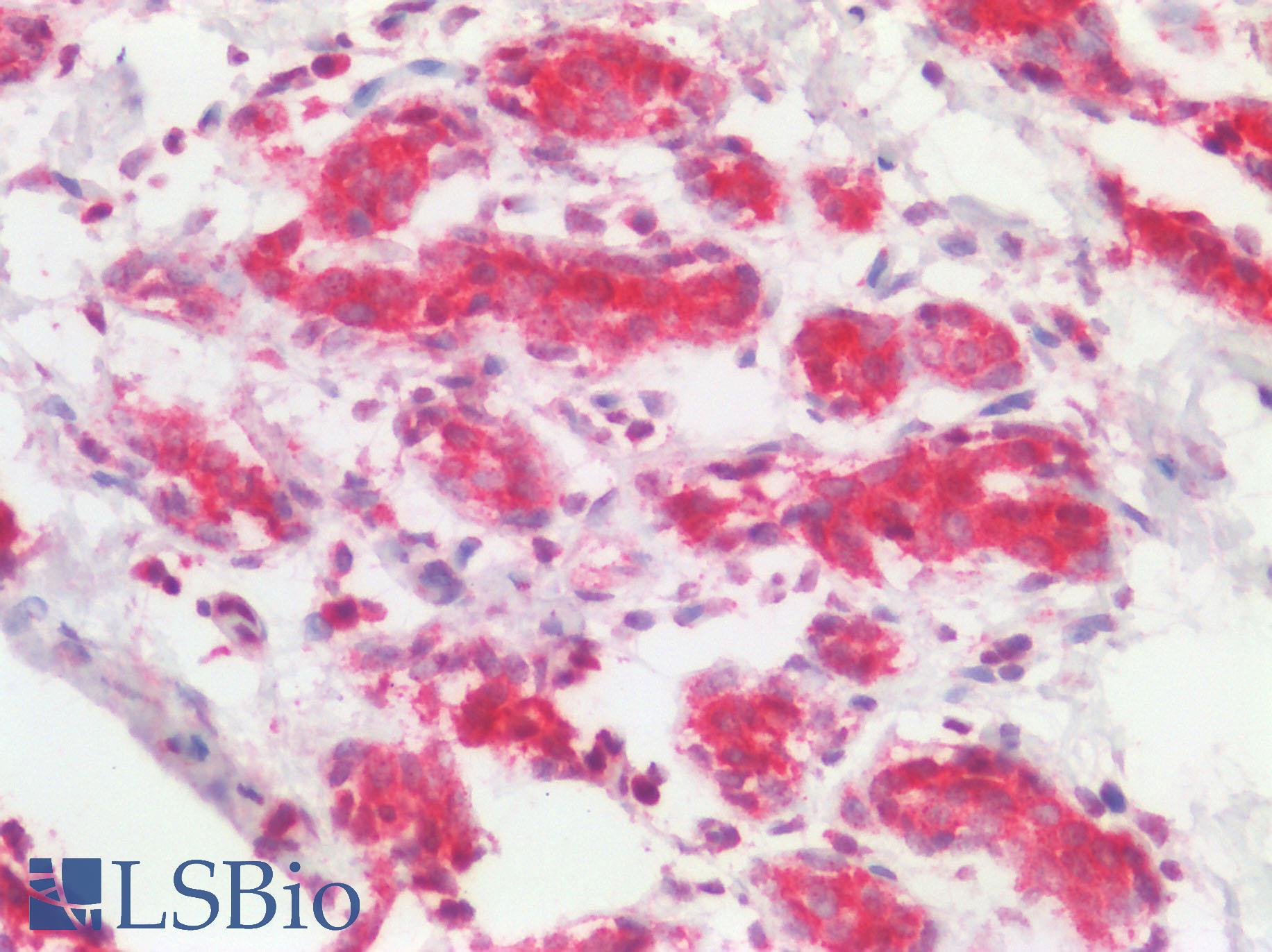TSLP Antibody - Human Breast Tubules: Formalin-Fixed, Paraffin-Embedded (FFPE)