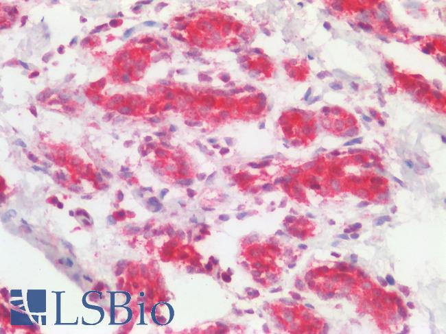 TSLP Antibody - Human Breast Tubules: Formalin-Fixed, Paraffin-Embedded (FFPE)