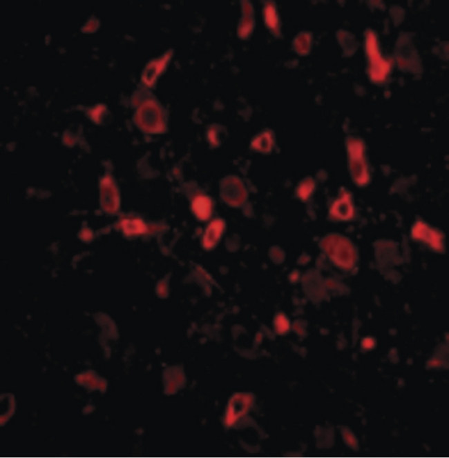 TSLP Antibody - Immunofluorescence of TSLP in Mouse Brain cells with TSLP antibody at 20 ug/ml.
