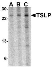TSLP Antibody - Western blot analysis of Anti-TSLP antibody in Mouse A-20 Cell Lines (LS-B3640; 15 µg of lysate per lane). Lane 1: Antibody concentration of 0.5 µg/ml. Lane 2: Antibody concentration of 1 µg/ml. Lane 3: Antibody concentration of 2 µg/ml. Antibody produced band at ~24 kDa. 