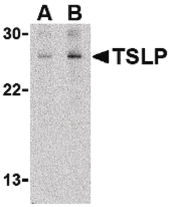 TSLP Antibody - Western blot of TSLP in Jurkat cell lysate with TSLP antibody at (A) 1 and (B) 2 ug/ml.