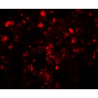 TSN / Translin Antibody - Immunofluorescence of Translin in human lung tissue with Translin antibody at 20 µg/mL.