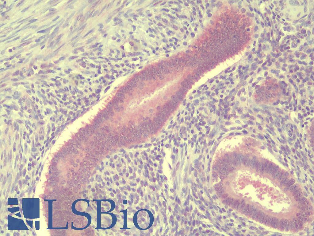 TSN / Translin Antibody - Anti-TSN / Translin antibody IHC staining of human uterus, endometrium. Immunohistochemistry of formalin-fixed, paraffin-embedded tissue after heat-induced antigen retrieval.