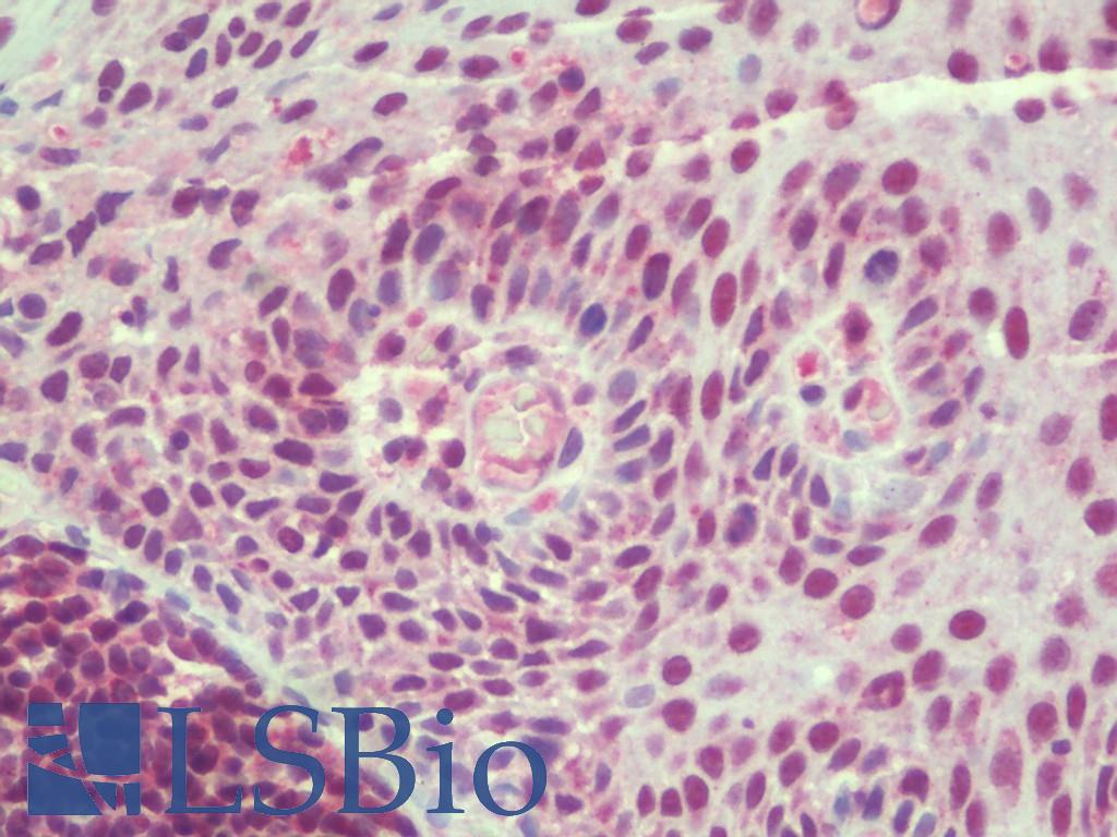 TSN / Translin Antibody - Anti-TSN / Translin antibody IHC staining of human tonsil. Immunohistochemistry of formalin-fixed, paraffin-embedded tissue after heat-induced antigen retrieval.