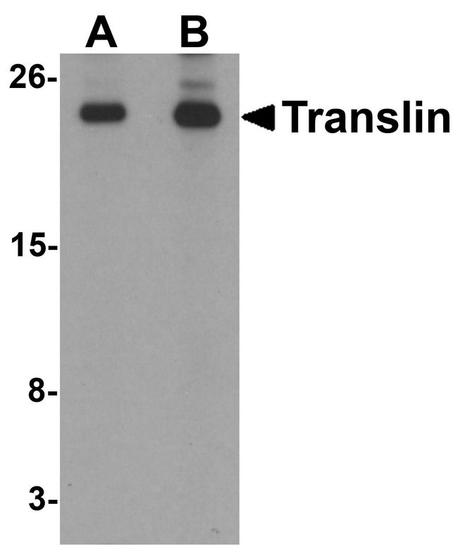 TSN / Translin Antibody - Western blot analysis of Translin in rat lung tissue lysate with Translin antibody at (A) 0.5 and (B) 1 ug/ml