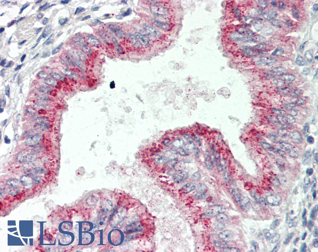 TSPAN1 / TM4SF Antibody - Human Uterus: Formalin-Fixed, Paraffin-Embedded (FFPE)