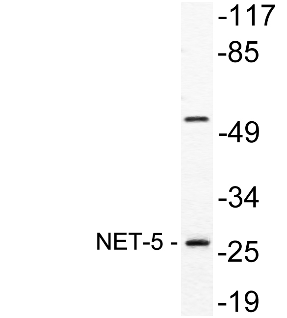 TSPAN9 Antibody - Western blot analysis of lysate from A549 cells, using NET-5 antibody.