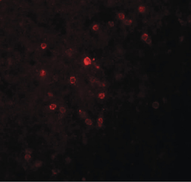 TSPAN9 Antibody - Immunofluorescence of TSPAN9 in human spleen tissue with TSPAN9 antibody at 20 ug/ml.