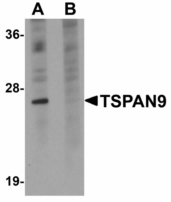 TSPAN9 Antibody - Western blot of TSPAN9 in EL4 cell lysate with TSPAN9 antibody at 1 ug/ml in (A) the absence and (B) the presence of blocking peptide.