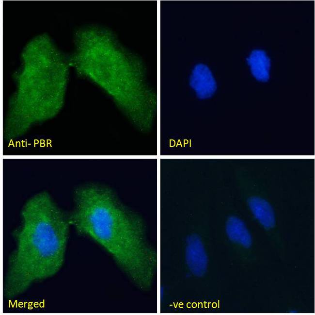 TSPO / PBR Antibody - PBR (mouse) Antibody Immunofluorescence analysis of paraformaldehyde fixed HeLa cells, permeabilized with 0.15% Triton. Primary incubation 1hr (10ug/ml) followed by Alexa Fluor 488 secondary antibody (2ug/ml), showing cytoplasmic staining. The nuclear stain is DAPI (blue). Negative control: Unimmunized goat IgG (10ug/ml) followed by Alexa Fluor 488 secondary antibody (2ug/ml).