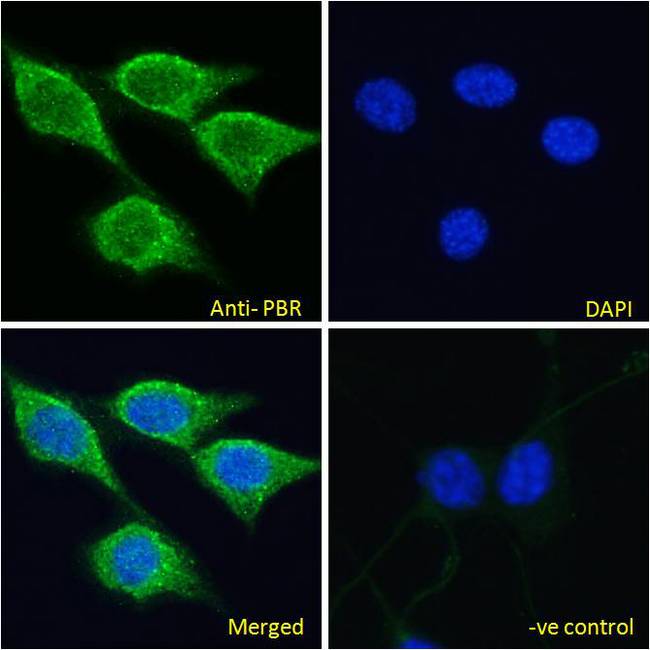 TSPO / PBR Antibody - PBR (mouse) Antibody Immunofluorescence analysis of paraformaldehyde fixed NIH3T3 cells, permeabilized with 0.15% Triton. Primary incubation 1hr (10ug/ml) followed by Alexa Fluor 488 secondary antibody (2ug/ml), showing mitochondrial /cytoplasmic staining. The nuclear stain is DAPI (blue). Negative control: Unimmunized goat IgG (10ug/ml) followed by Alexa Fluor 488 secondary antibody (2ug/ml).