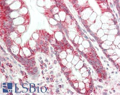 TSPO / PBR Antibody - Human Small Intestine: Formalin-Fixed, Paraffin-Embedded (FFPE)