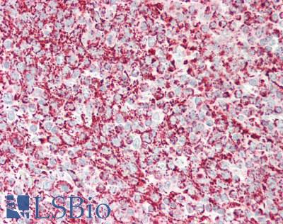 TSPO / PBR Antibody - Human Tonsil: Formalin-Fixed, Paraffin-Embedded (FFPE)