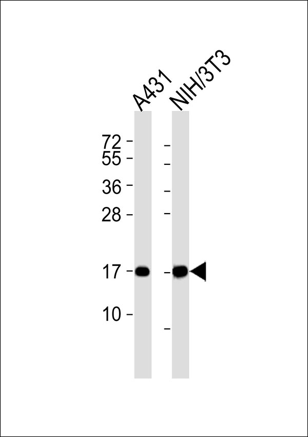 TSPO / PBR Antibody - All lanes : Anti-PBR Antibody at 1:1000 dilution Lane 1: A431 whole cell lysates Lane 2: NIH/3T3 whole cell lysates Lysates/proteins at 20 ug per lane. Secondary Goat Anti-Rabbit IgG, (H+L),Peroxidase conjugated at 1/10000 dilution Predicted band size : 19 kDa Blocking/Dilution buffer: 5% NFDM/TBST.