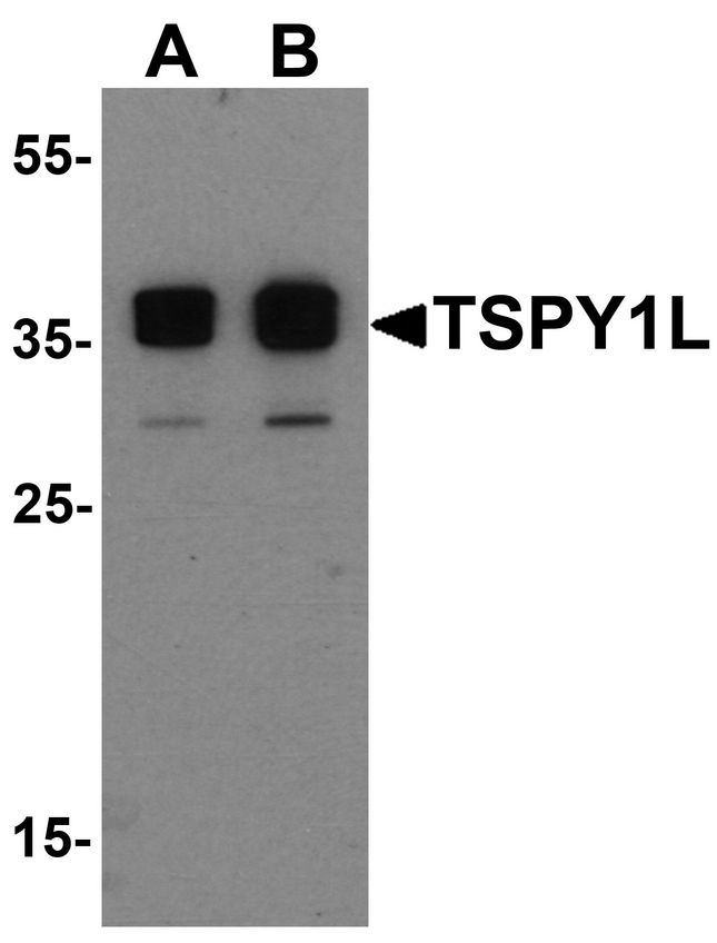 TSPY1 / TSPY Antibody - Western blot analysis of TSPY1L in A20 cell lysate with TSPY1L antibody at (A) 0.5 and (B) 1 ug/ml