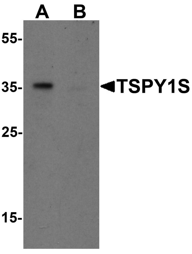 TSPY1 / TSPY Antibody - Western blot analysis of TSPY1S in A20 cell lysate with TSPY1S antibody at 1 ug/ml in (A) the absence and (B) the presence of blocking peptide.