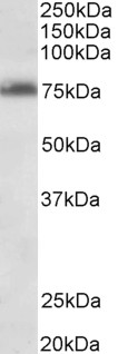 TSPYL2 / DENTT Antibody - TSPYL2 antibody (0.3 ug/ml) staining of Jurkat lysate (35 ug protein in RIPA buffer). Primary incubation was 1 hour. Detected by chemiluminescence.