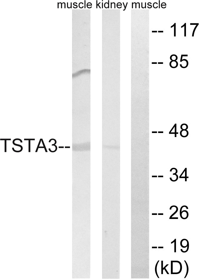 TSTA3 /  GDP-L-Fucose Synthase Antibody - Western blot analysis of lysates from rat kidney and rat muscle cells, using TSTA3 Antibody. The lane on the right is blocked with the synthesized peptide.
