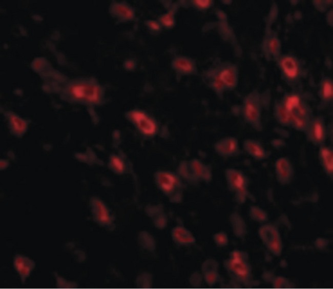 TTBK1 Antibody - Immunofluorescence of TTBK1 in Human Brain cells with TTBK1 antibody at 20 ug/ml.