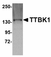 TTBK1 Antibody - Western blot of TTBK1 in Jurkat lysate with TTBK1 antibody at 1 ug/ml.